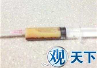 看世界杯大吃大喝 他抽出半管血半管油