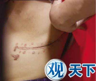 江西团伙圈养供体贩肾,以海鲜的名义运出!