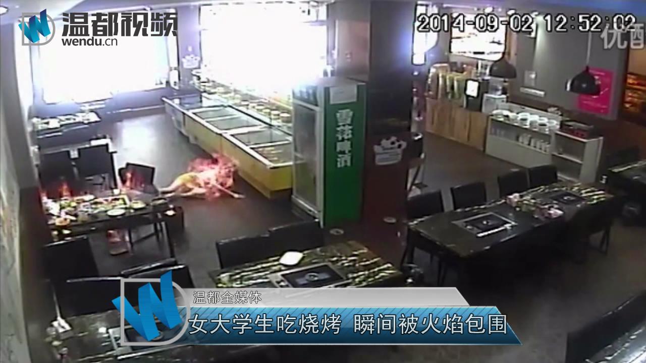 温大一女生吃烧烤被严重烧伤