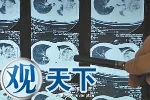 暴食后去跳舞 她把胃“跳”进胸腔