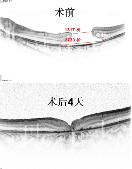 激光笔的危害性 1564534608622.png